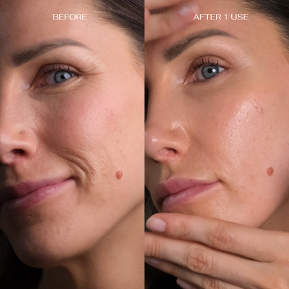 Intensely Hydrating Face and Neck Care Set