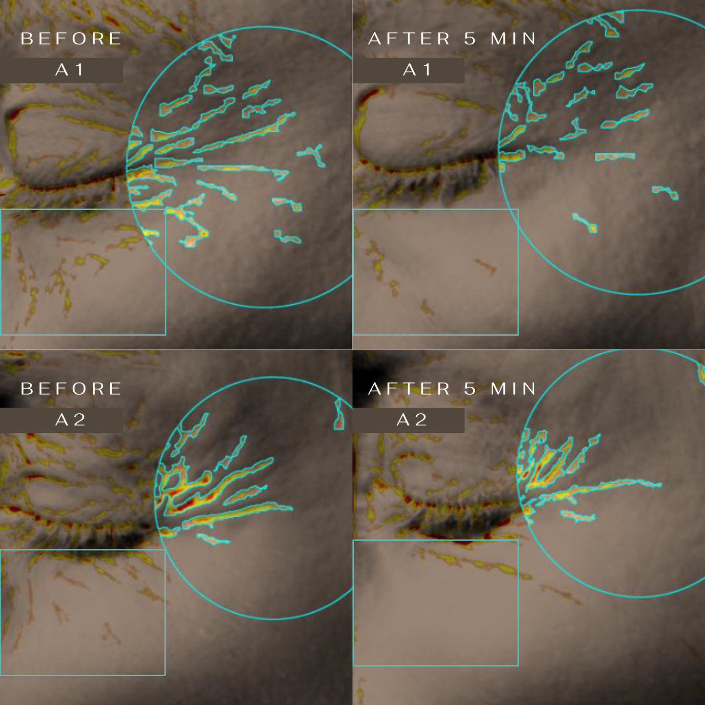 CLM 5 Minute Revolution Under-Eye Patches