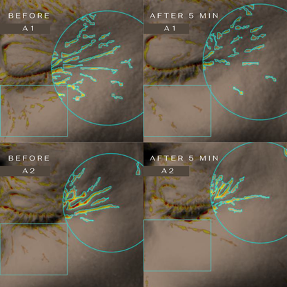 CLM 5 Minute Revolution Under-Eye Patches