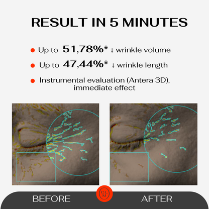 CLM 5 Minute Revolution Under-Eye Patches
