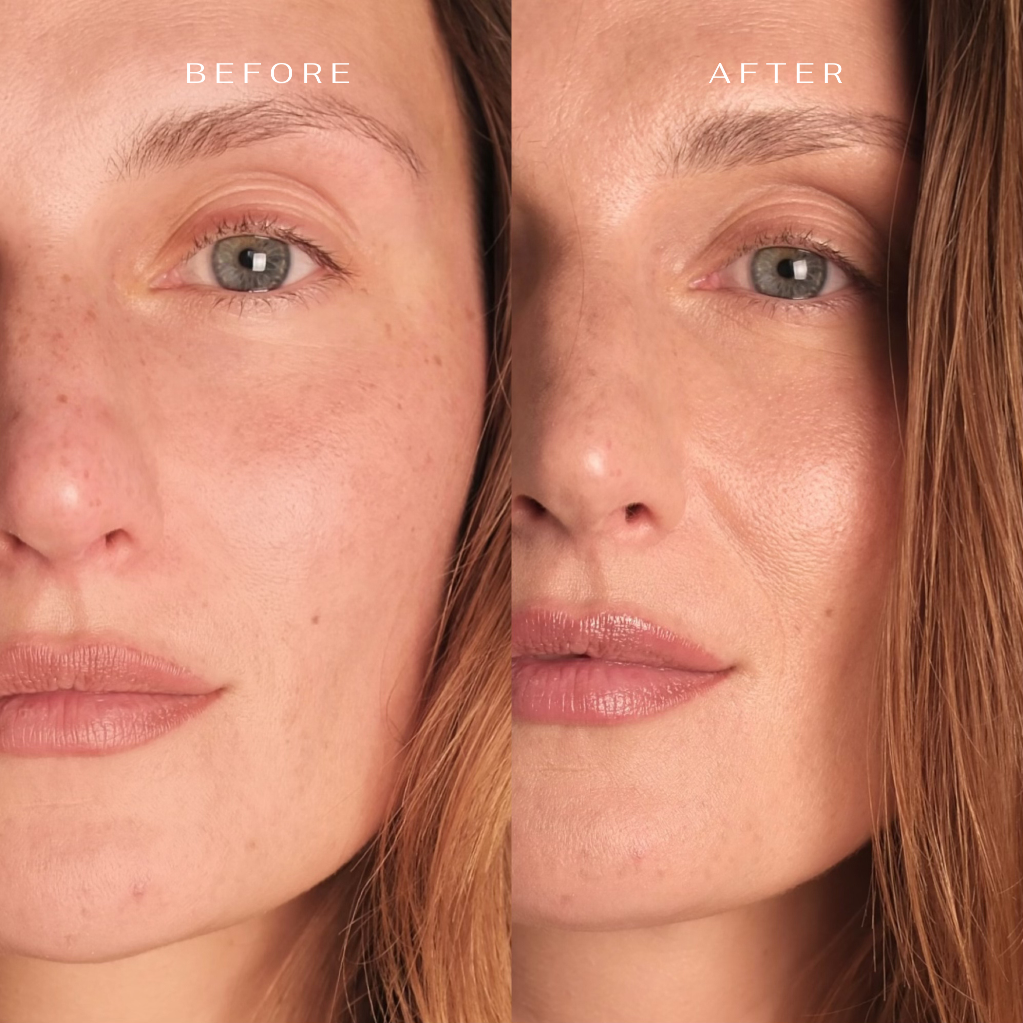 Moisturizing Facial Treatment Mask