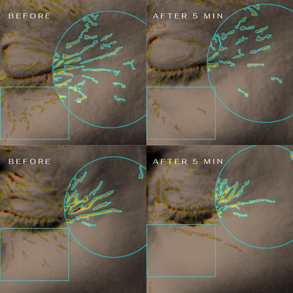 CLM 5 Minute Revolution Under-Eye Patches