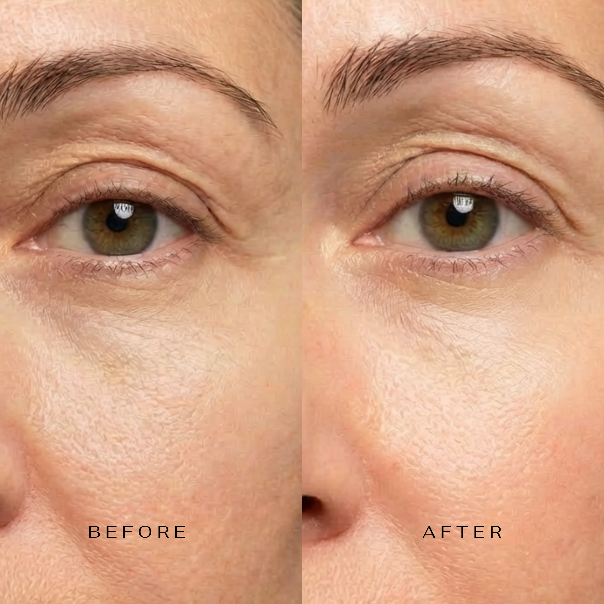 CLM 5 Minute Revolution Under-Eye Patches