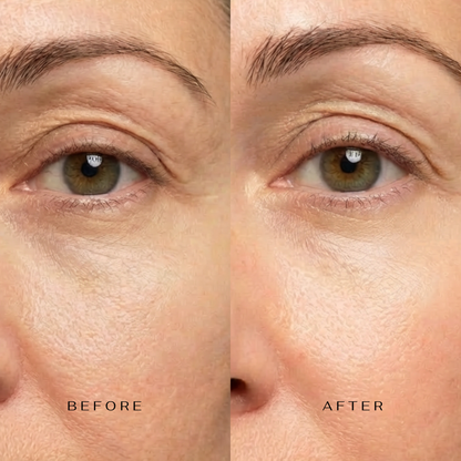 CLM 5 Minute Revolution Under-Eye Patches
